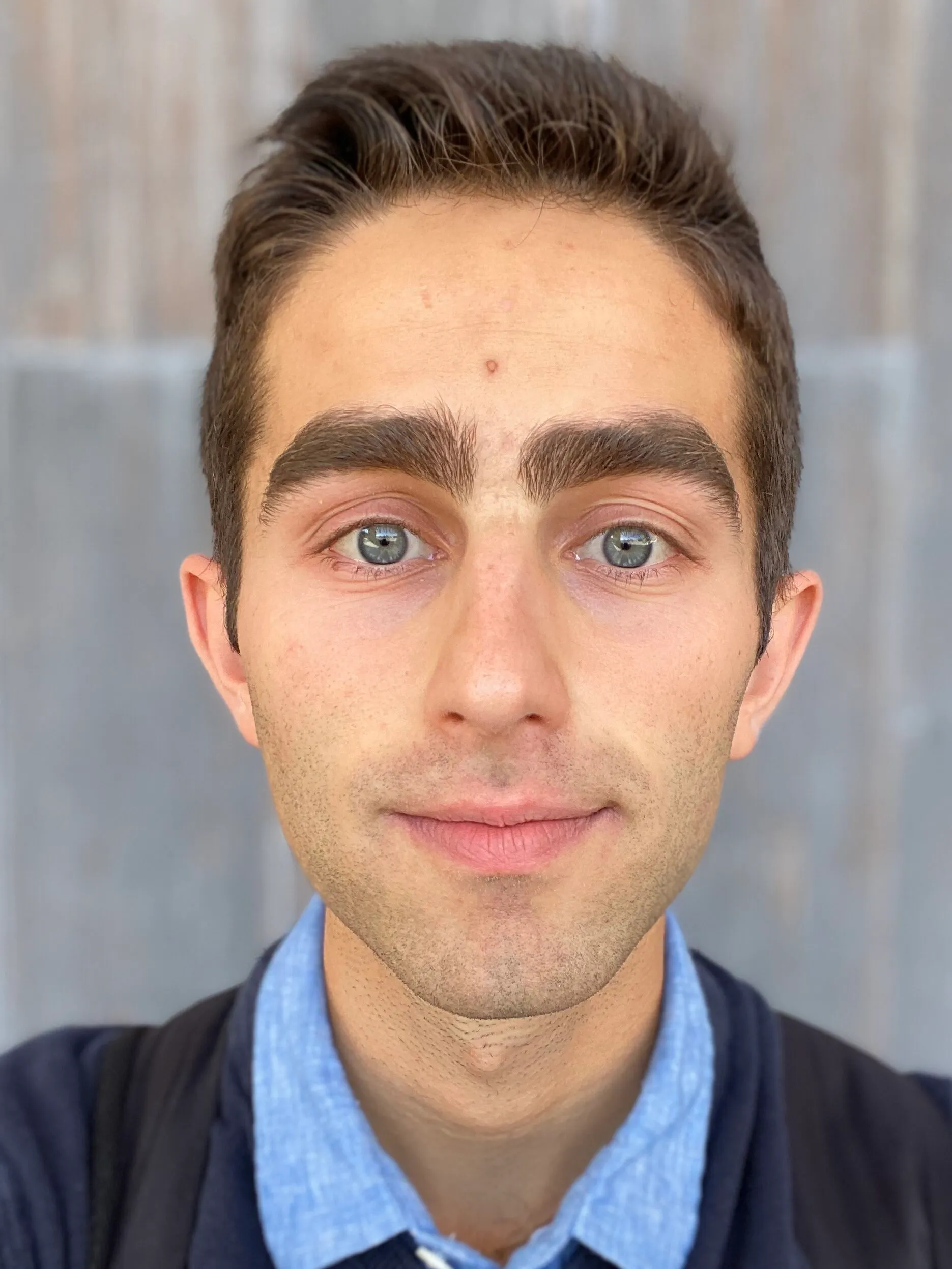 Photo showing skin before using the skincare in this article